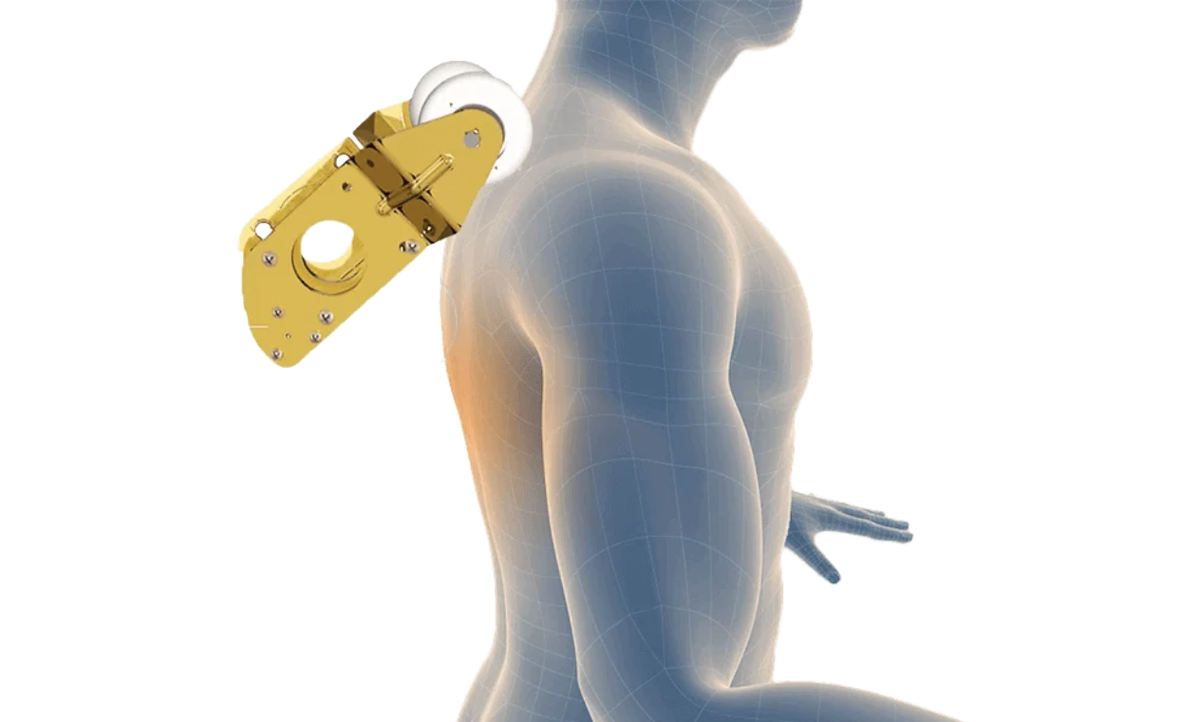 3D Smart Roller Technology